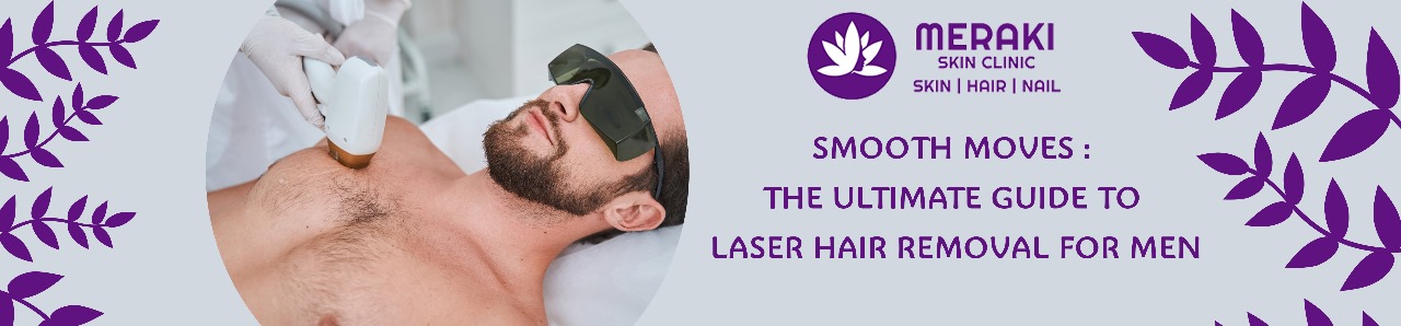 Smooth Moves: The Ultimate Guide to Laser Hair Removal for Men;